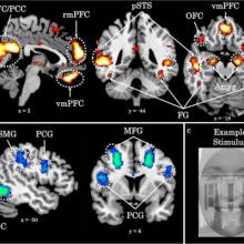 brain images